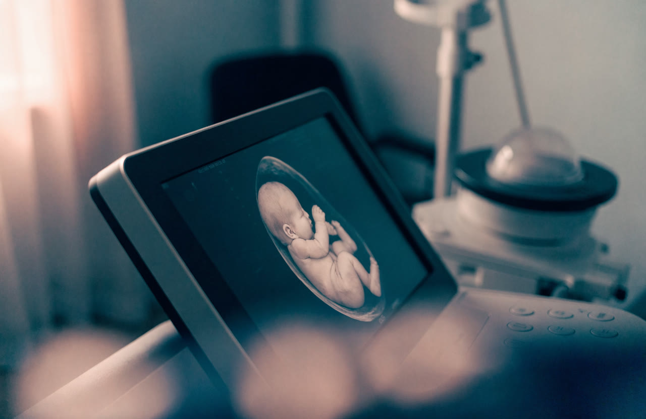 3D / 4D Ultrasonografi kapak görseli